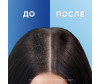  Head & Shoulders            400  - Head & Shoulders         400 